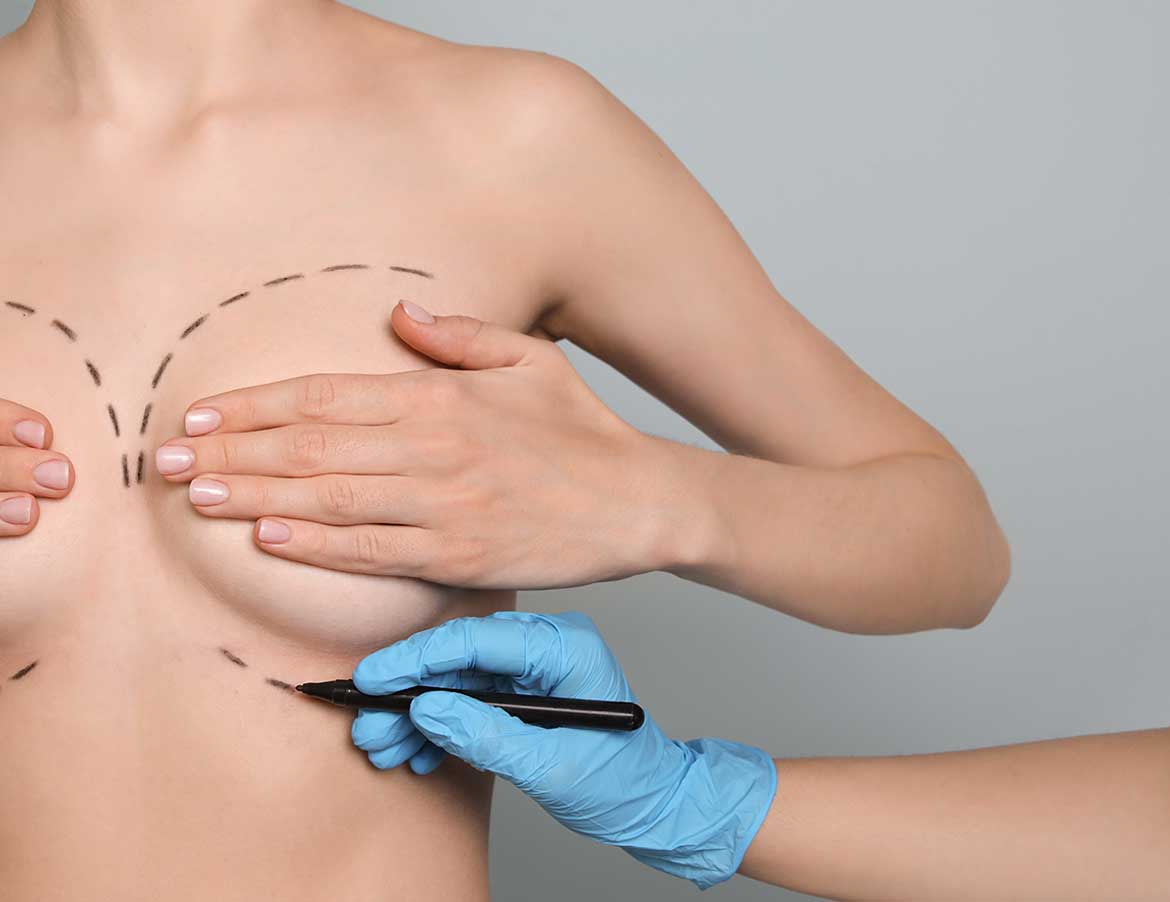 Signature Plastic & Reconstructive Surgery - Breast Augmentation