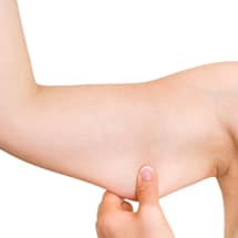 Signature Plastic & Reconstructive Surgery - hand and arm - arm lift - body procedures