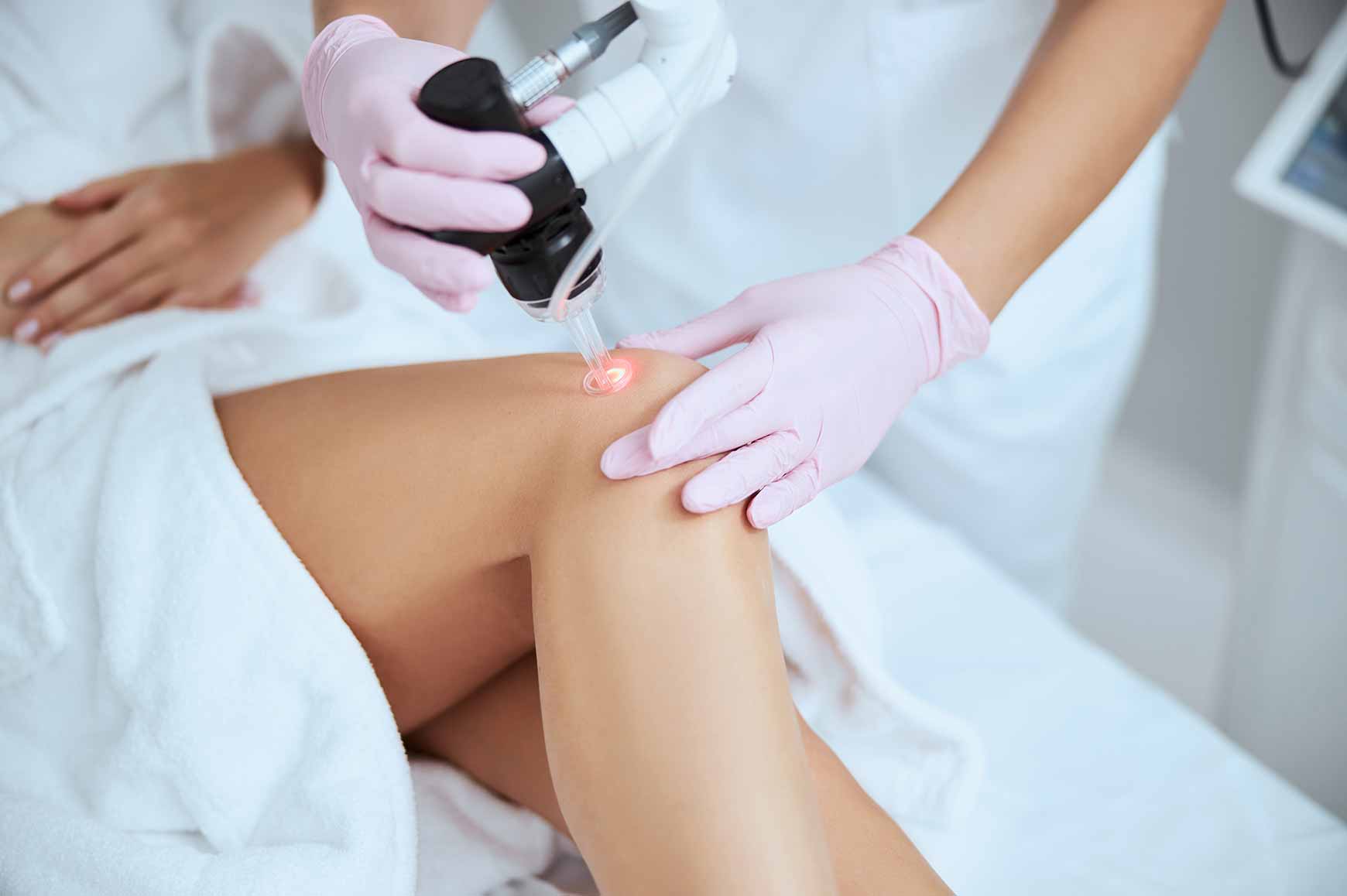 Laser therapy to help treat spider veins - contact Dr. Melissa Marks.