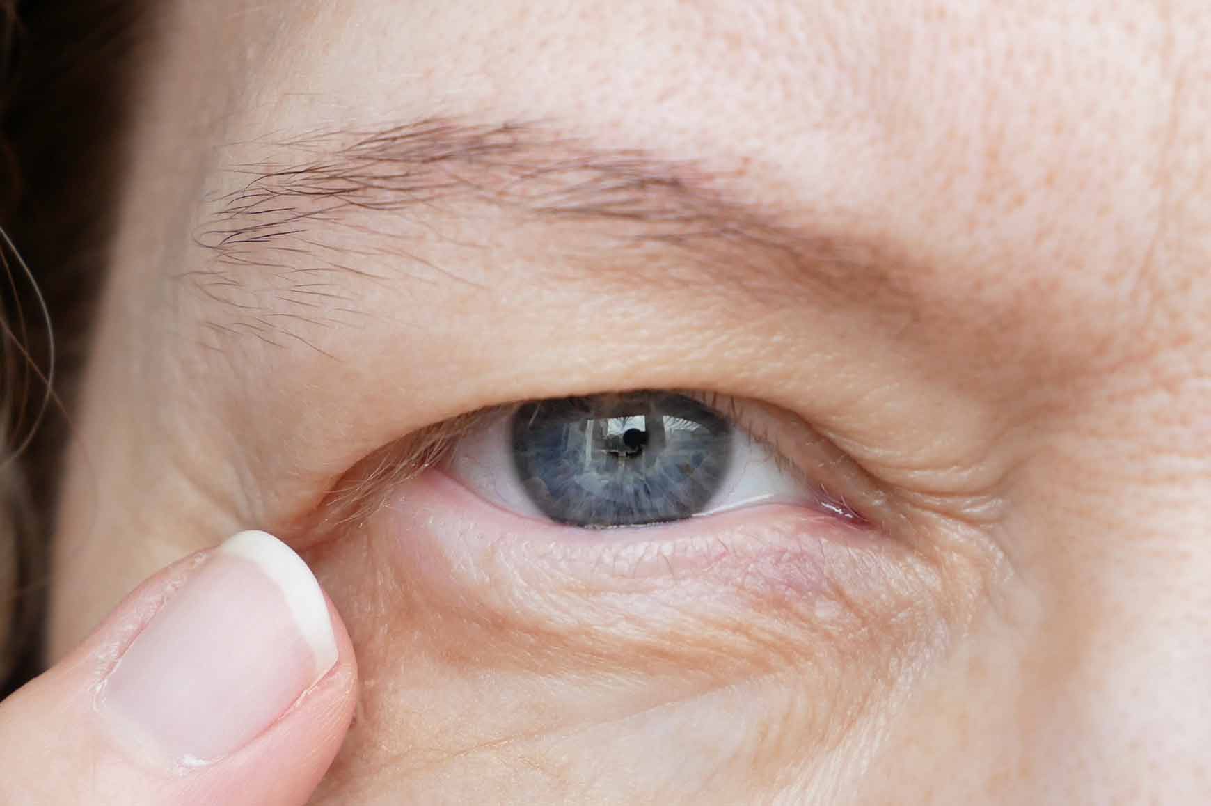 Do you need eyelid surgery? Contact Dr. Melissa Marks to find out more.