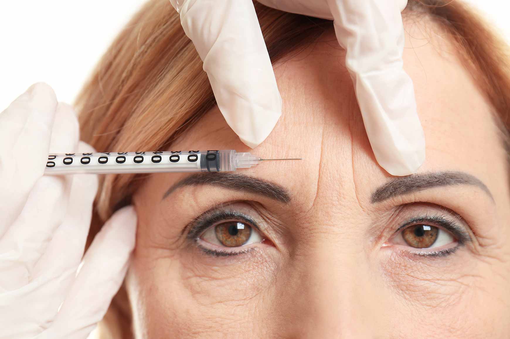 When you start noticing issues with your skin-like lines, you should consider Botox.