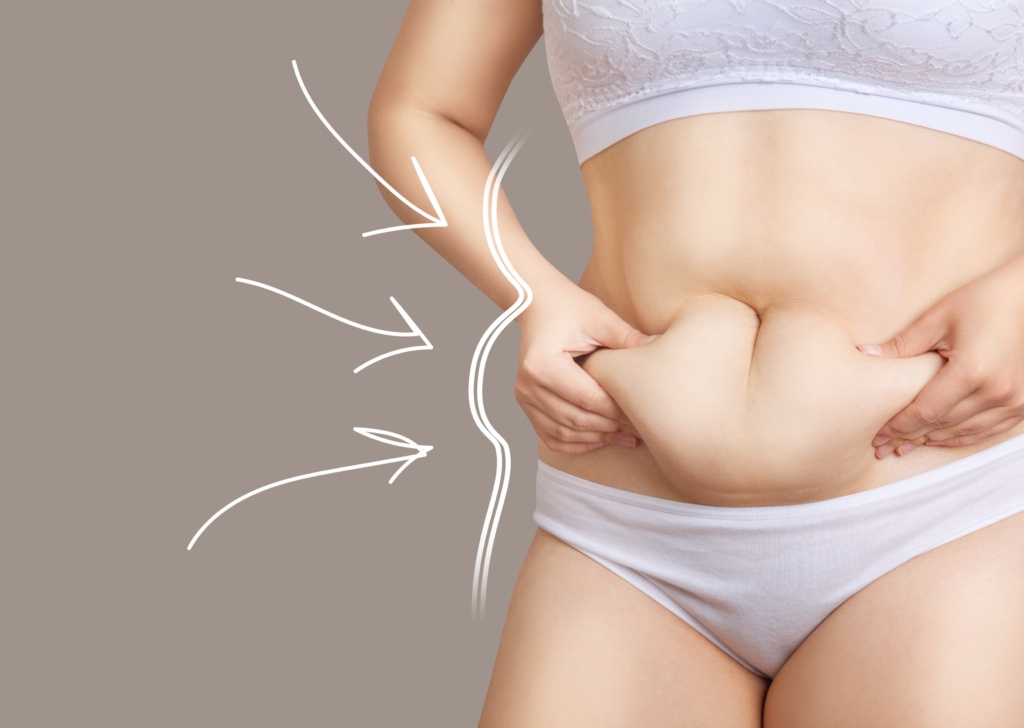 tummy tuck charlotte nc