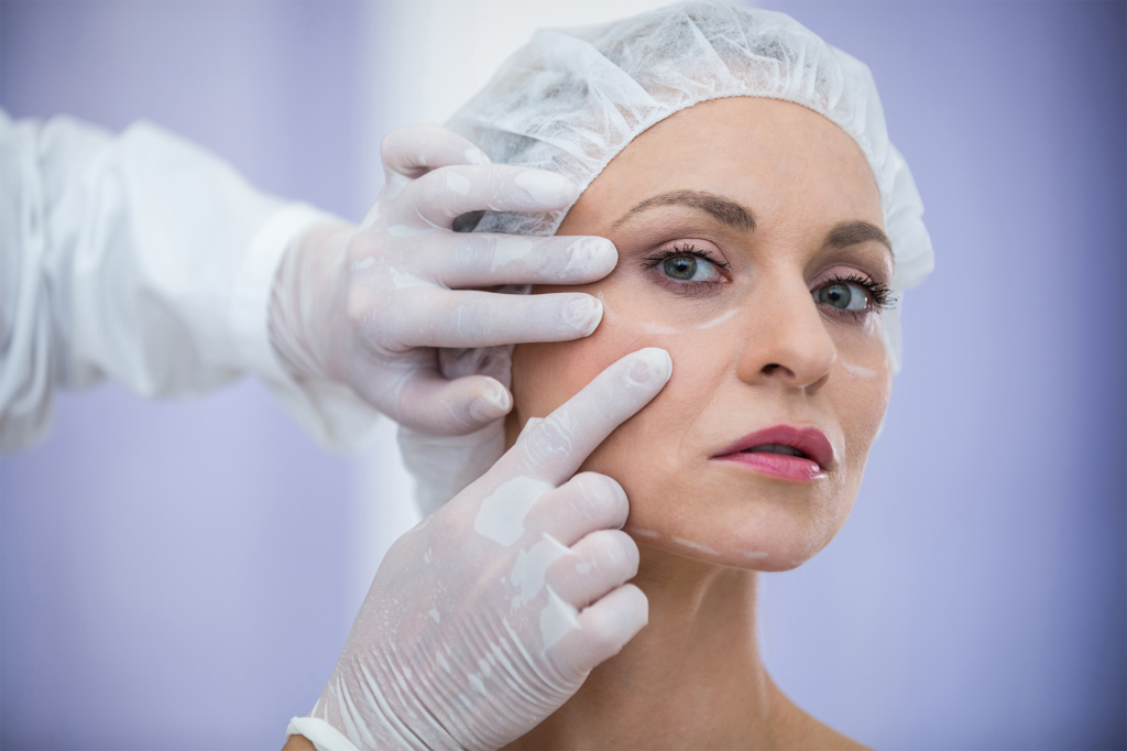 botox vs dysport
