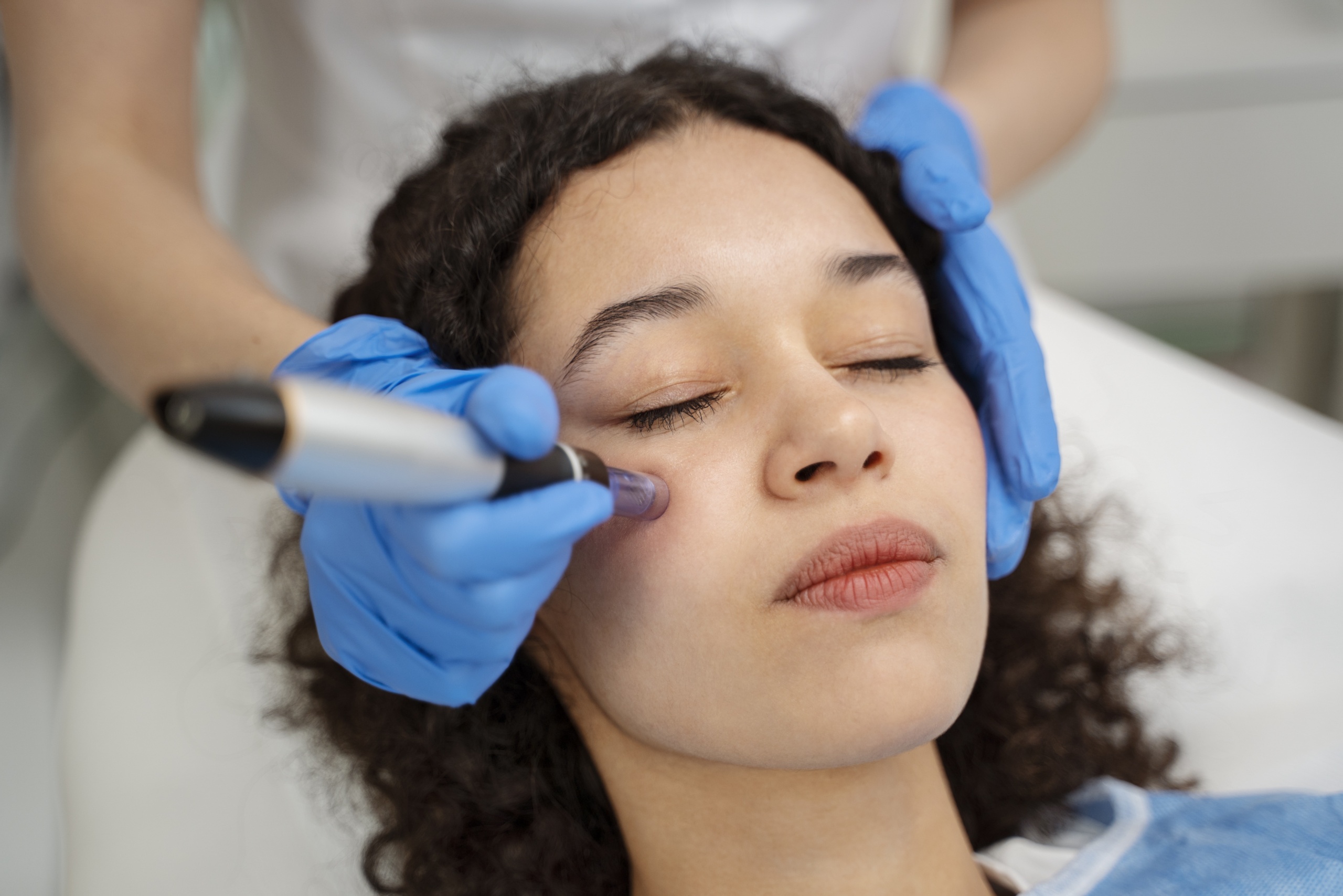 rf microneedling vs laser resurfacing