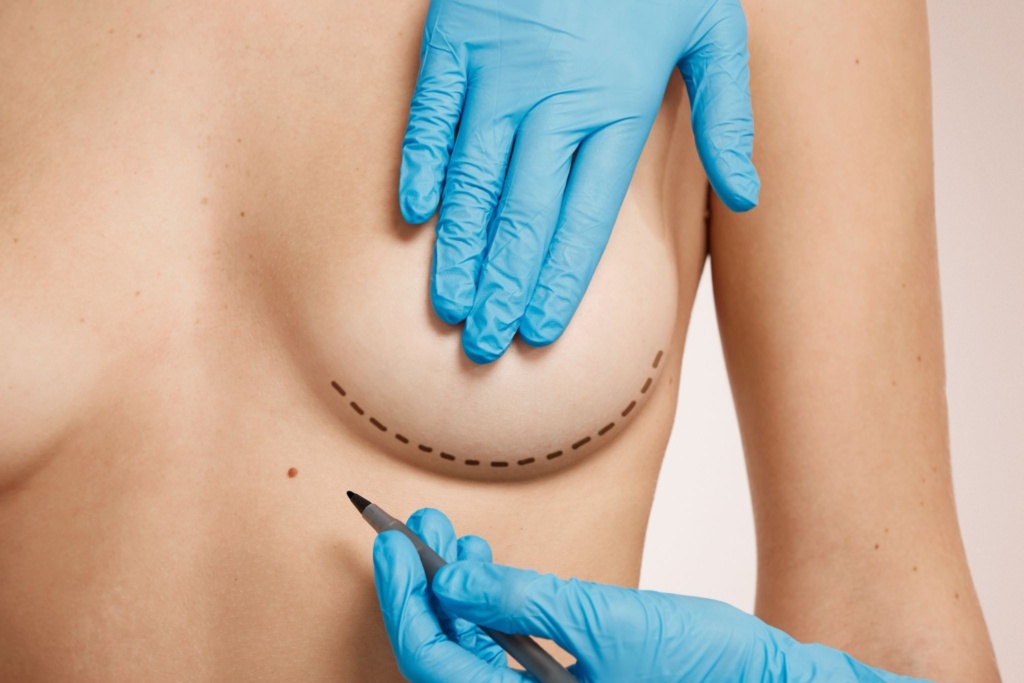 breast implant illness Charlotte