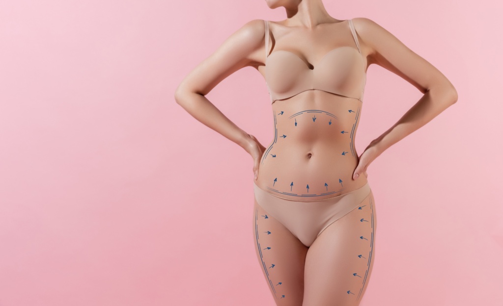 How Much Does Liposuction Cost in Charlotte?