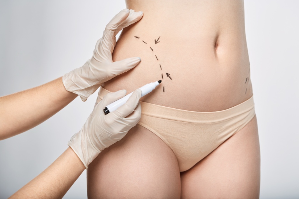 body contouring cost in Charlotte
